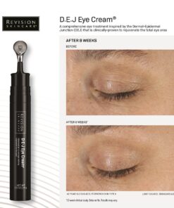 Revision D.E.J Eye 14g