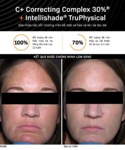 Revision Skincare C+Correcting Complex 30% 15ml