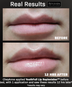 Revision Youthfull Lip Replenisher 9.4g