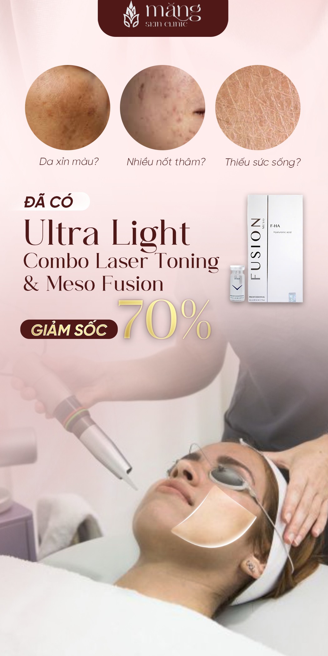 ULTRA LIGHT – LIỆU TRÌNH TRẮNG SÁNG VƯỢT TRỘI: GIẢM ĐẾN 70%