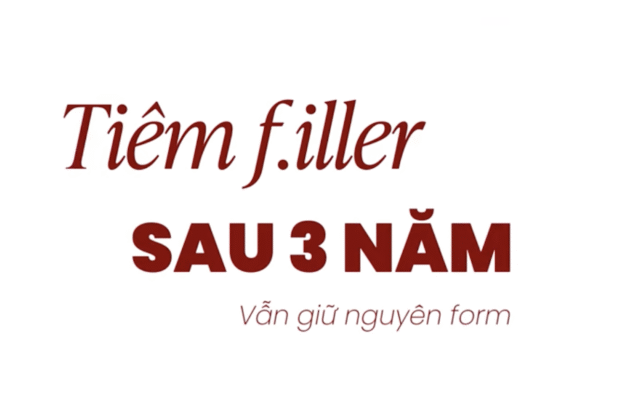Tiêm Filler sau 3 năm vẫn y nguyên cẩn thận bom nổ chậm
